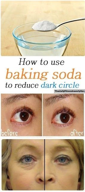 How To Get Rid Of Dark Circles Overnight? -   18 how to get rid of dark circles under eye ideas
