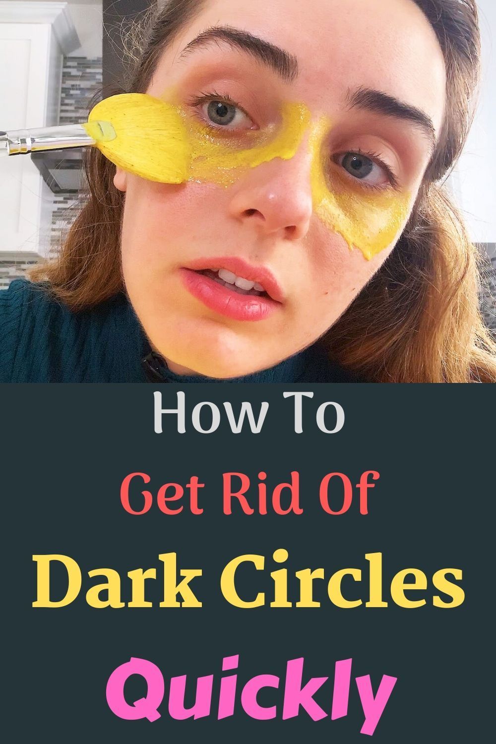 How To Get Rid Of Dark Circles Quickly -   18 how to get rid of dark circles under eye ideas