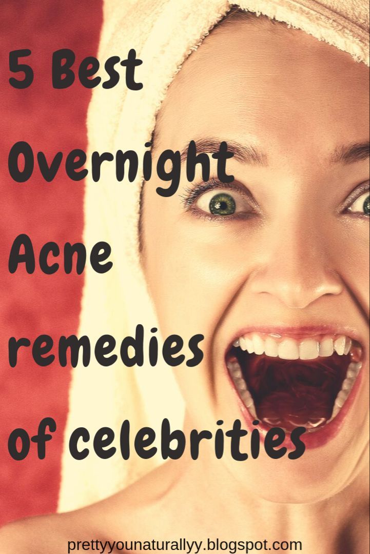 5 SECRET acne overnight treatments used by celebrities !!! -   19 how to get rid of pimples ideas