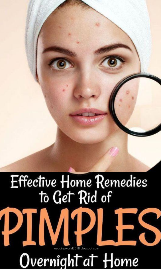 Effective Home Remedies To Get Rid Of Pimples Overnight At Home -   19 how to get rid of pimples ideas