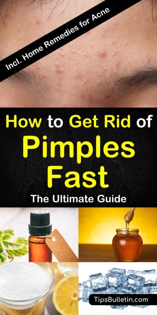 8 Great Home Remedies to Get Rid of Pimples Fast -   19 how to get rid of pimples ideas