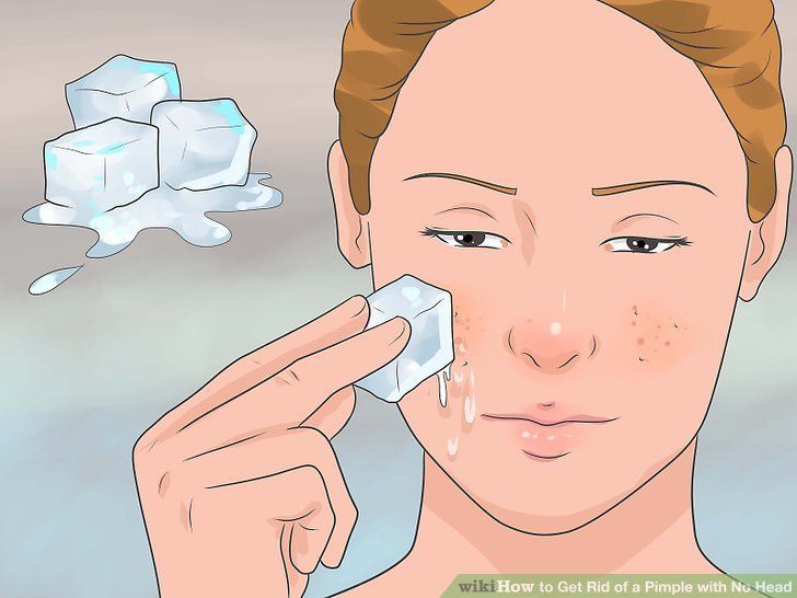 How to Get Rid of a Pimple with No Head -   19 how to get rid of pimples ideas